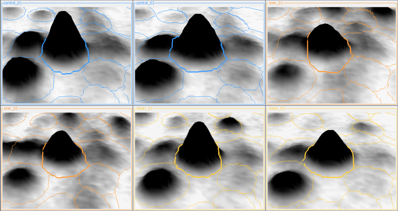 [img: 3D view for a certain Gel Image Region]