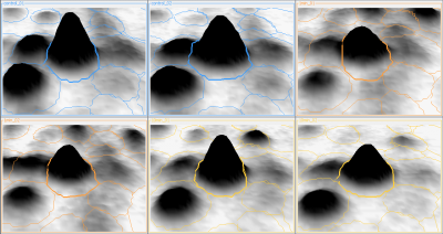 3D View in Gel Image Regions