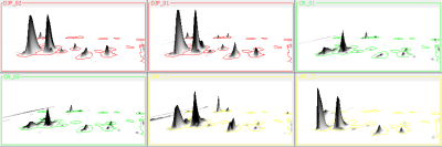 3D View in Image Regions 3D View in Image Regions